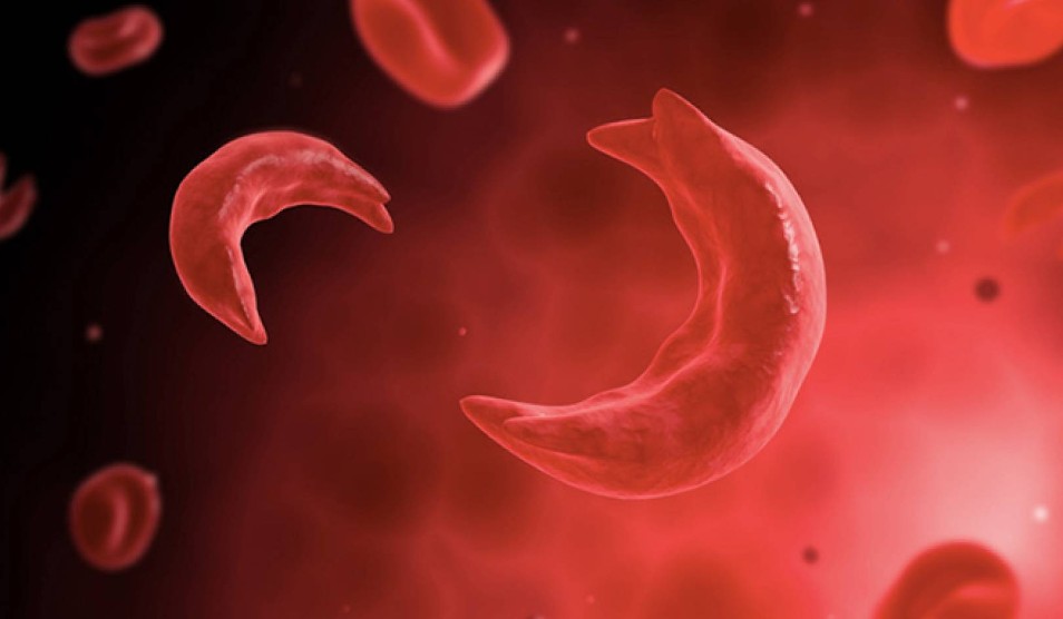 gene therapy approval