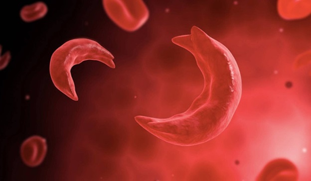 gene therapy approval